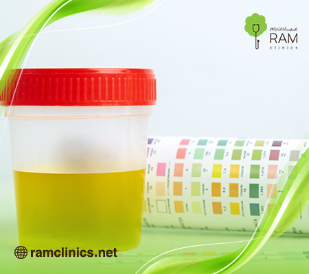 اسباب-تغير-لون-البول