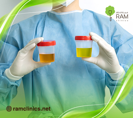 لون-البول-أصفر-ليموني-للكبار