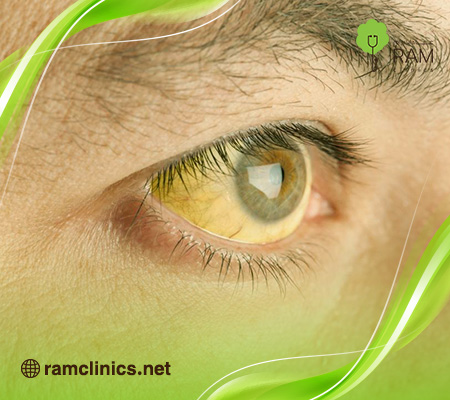 أسباب-أبو-صفار-للكبار