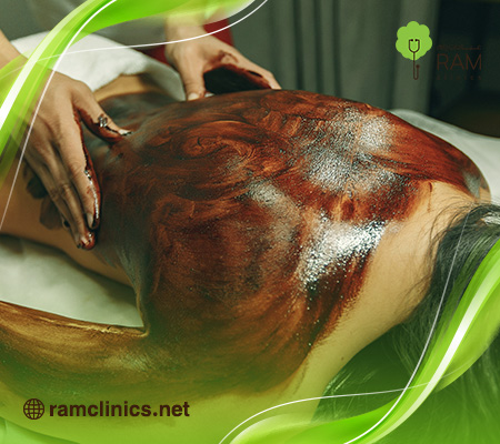 علاج-اثار-الحروق