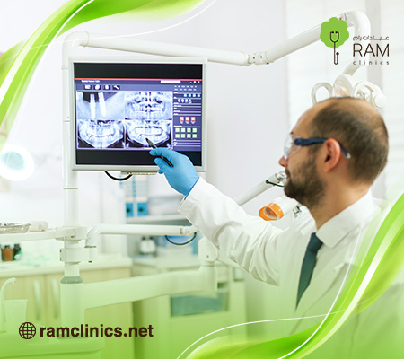 اشعة-بانوراما-للاسنان