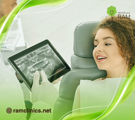 سعر-اشعة-بانوراما-للاسنان