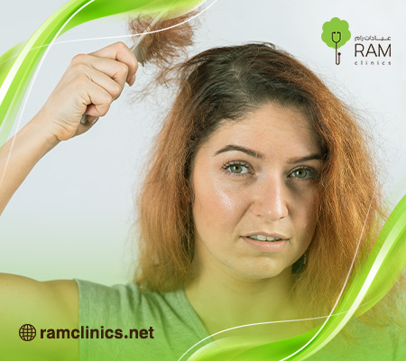 علاج-الشعر-المحروق