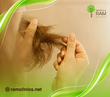 إزالة-تقصف-الشعر-في-يومين