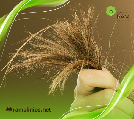 إزالة-تقصف-الشعر-في-يومين