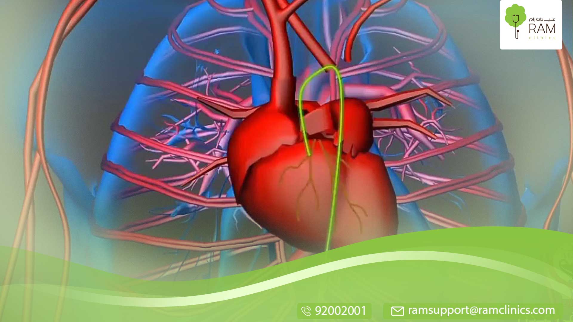 ما هي قسطرة القلب؟