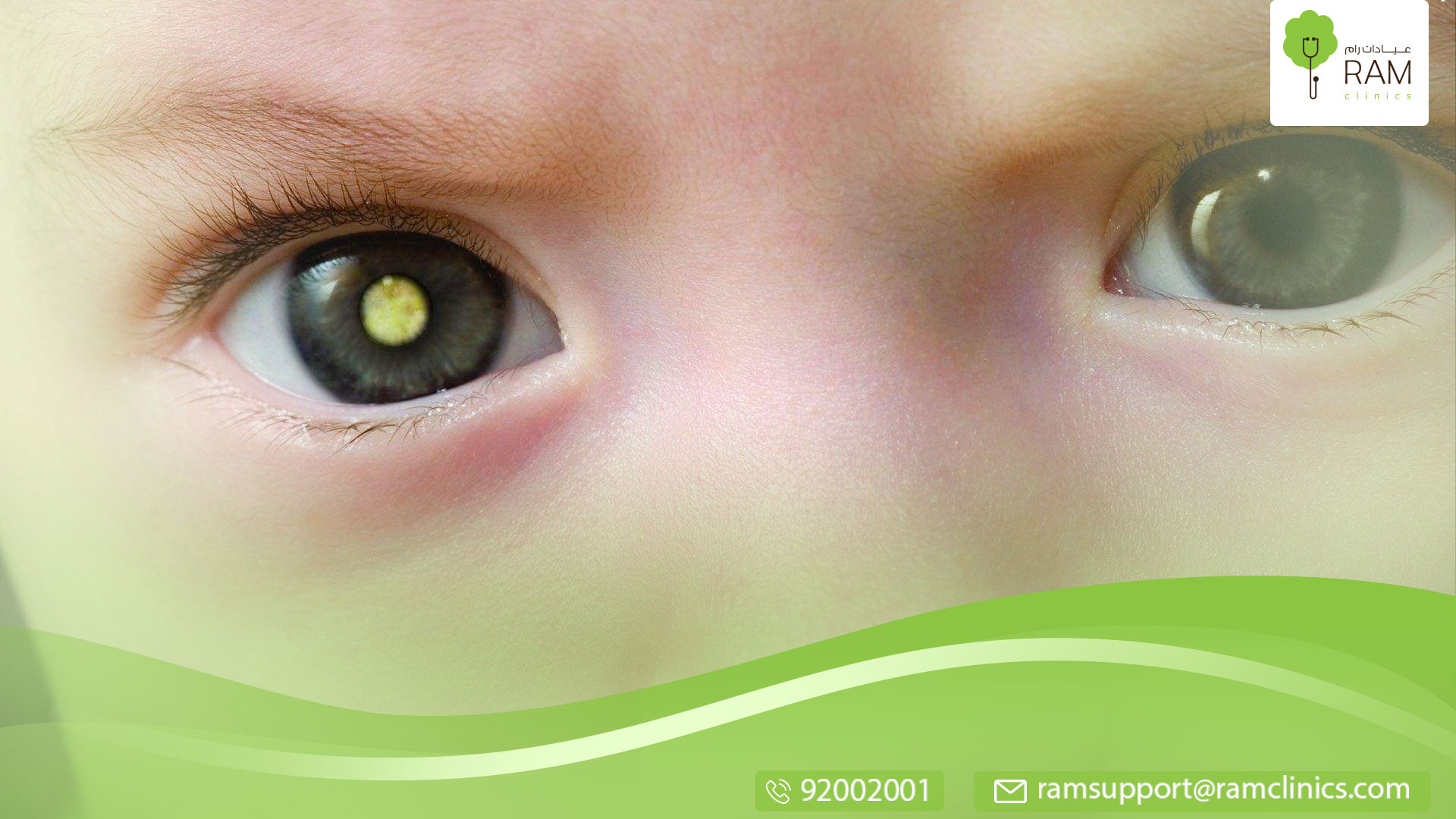 سرطان العين لدى الأطفال