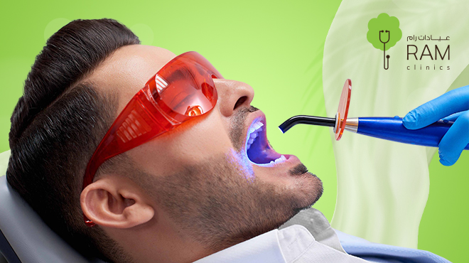 ما تقدمه عيادات رام في تقنيات تنظيف وتبييض الأسنان