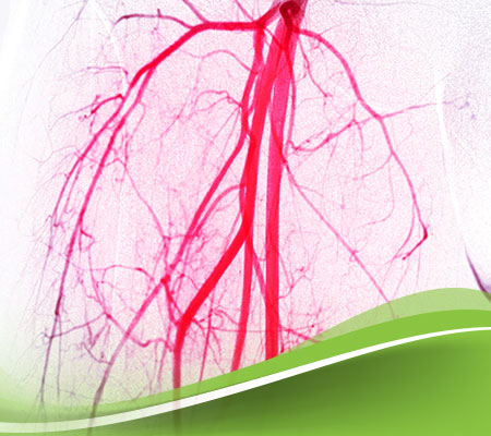 مرض تمدد الاوعية الدموية: الأسباب والأعراض وعلاج تمدد الأوعية الدموية