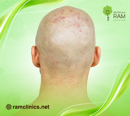 اقوي-حبوب-الشعر