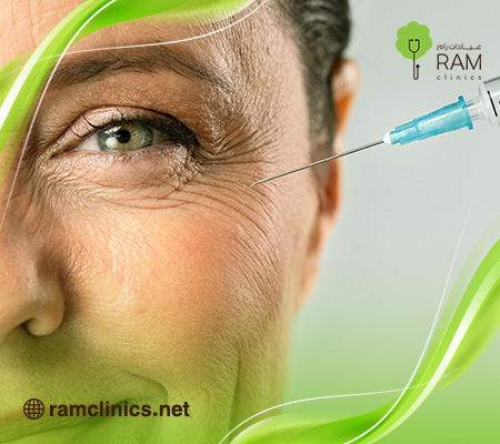 كيف اتخلص من تشققات الجسم