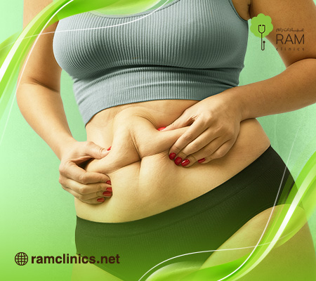 اسباب توسع المعده بعد التكميم