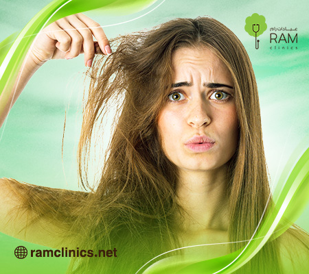 علاج-الشعر-المحروق