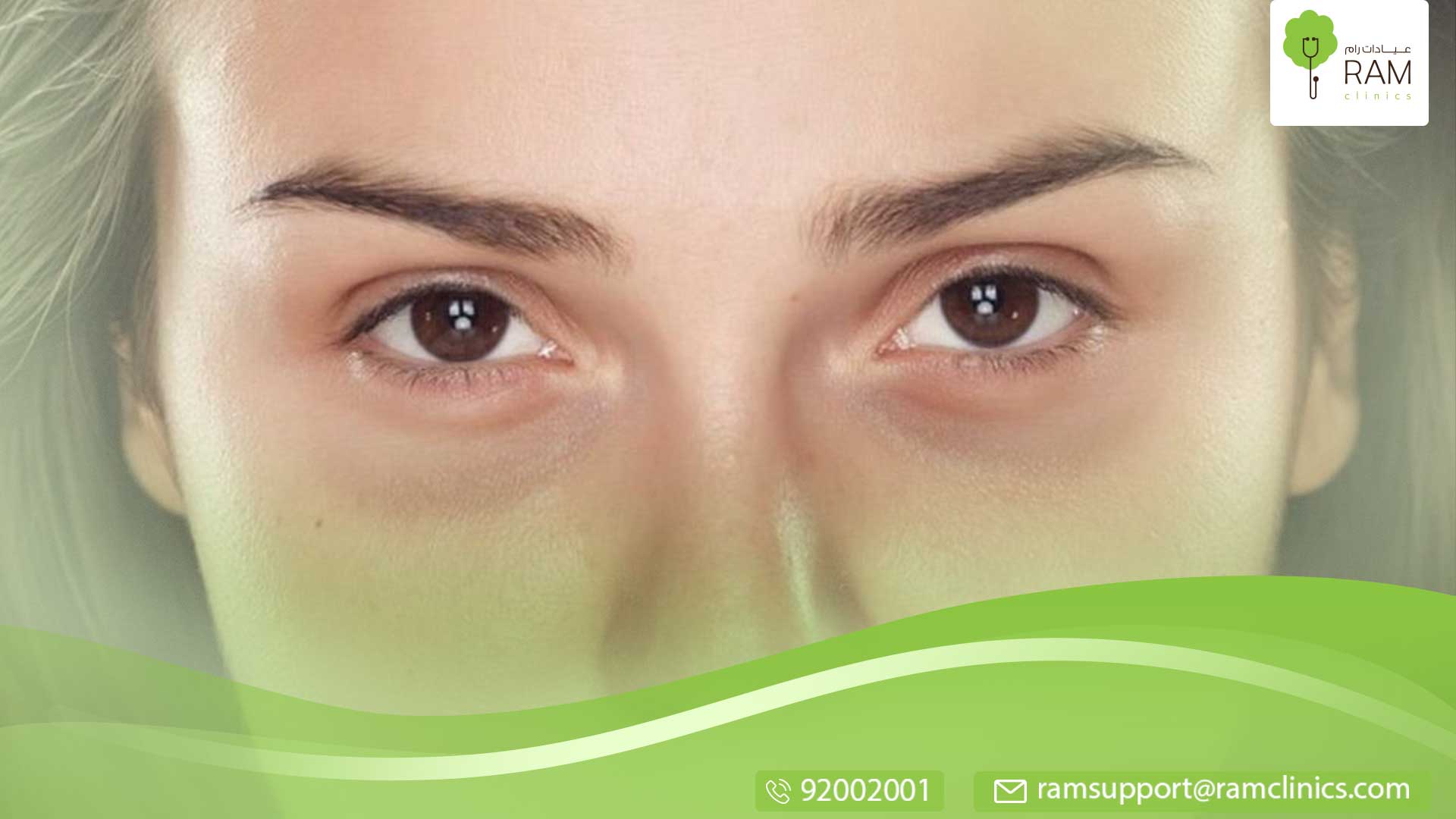 العين السوداء