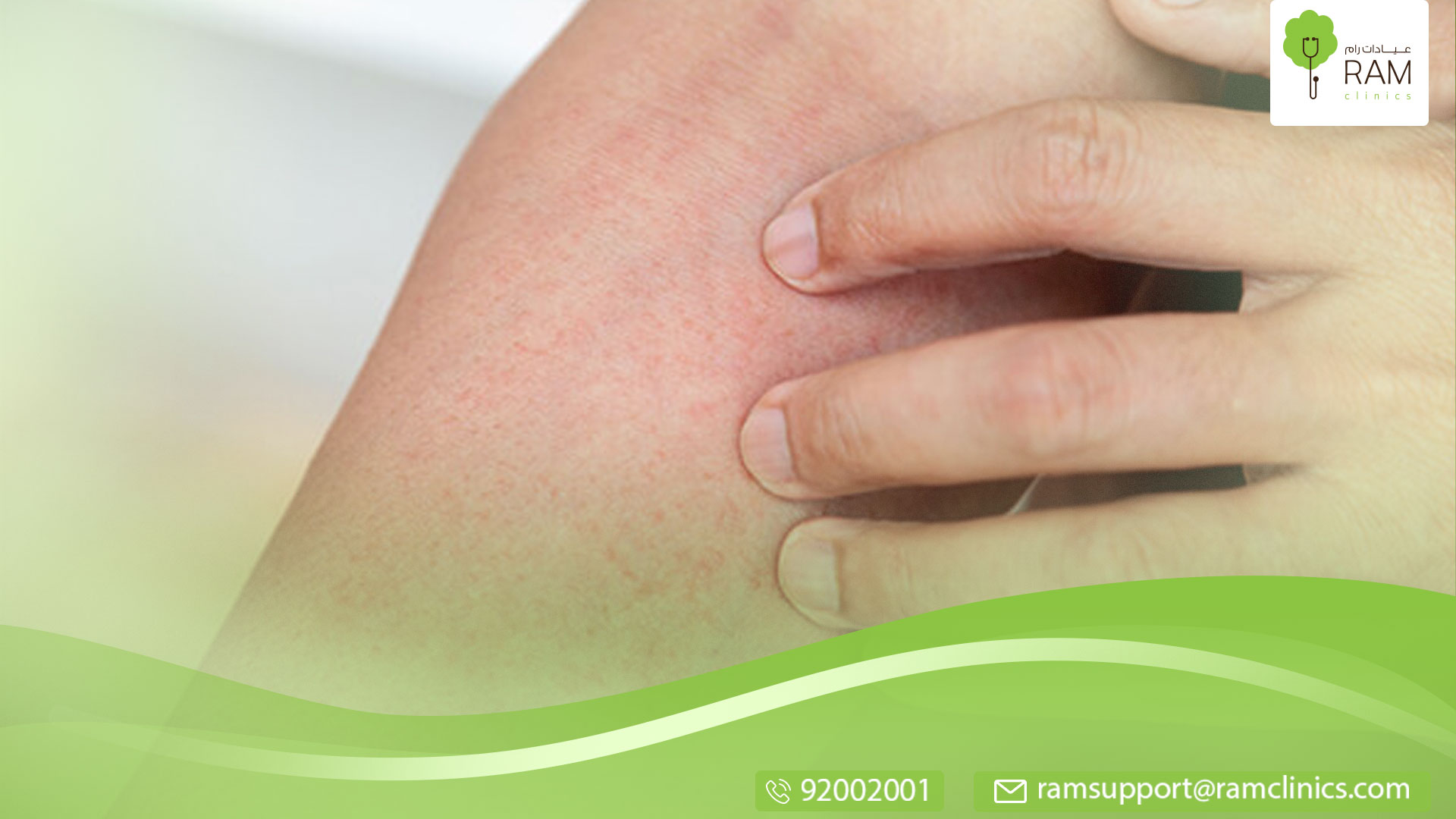 تعرف علي أنواع الحساسية