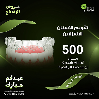 Invisalign braces in monthly installments