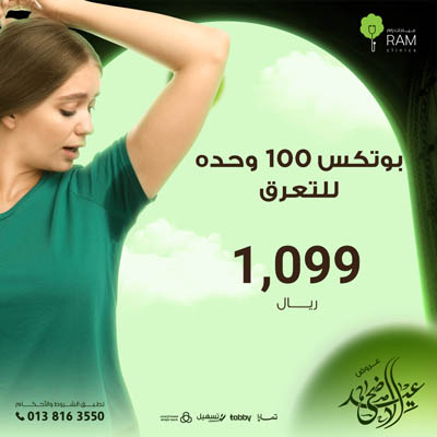 Botox 100 units for sweating