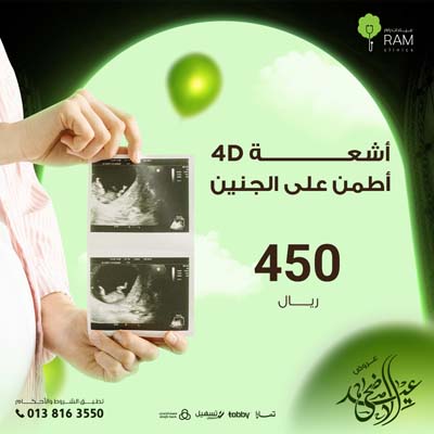 أشعة 4D اطمن على الجنين