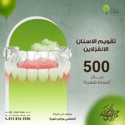 تقويم الاسنان الانفزلاين بأقساط شهرية