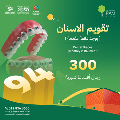 Orthodontics in monthly installments