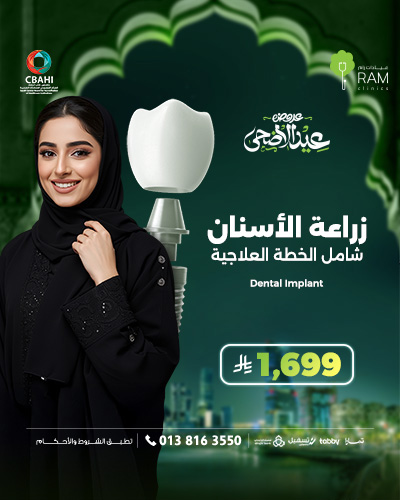 زراعة الأسنان شامل الخطة العلاجية