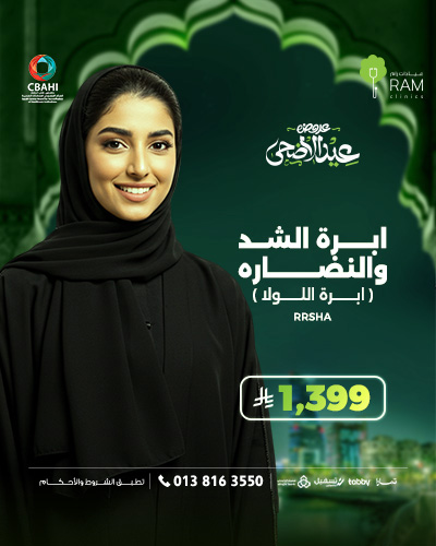 ابره الشد و النضاره ابره اللولا
