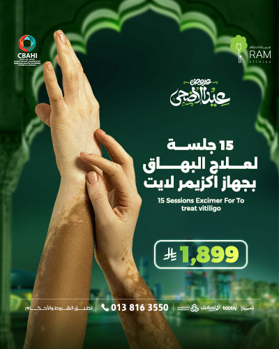 15 جلسه لعلاج البهاق بجهاز اكزيم لايت