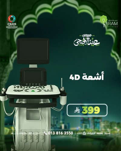 4D rays