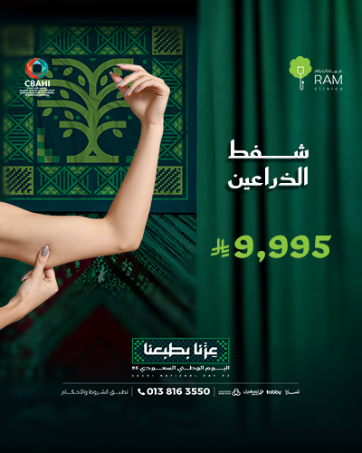 شفط الذراعين